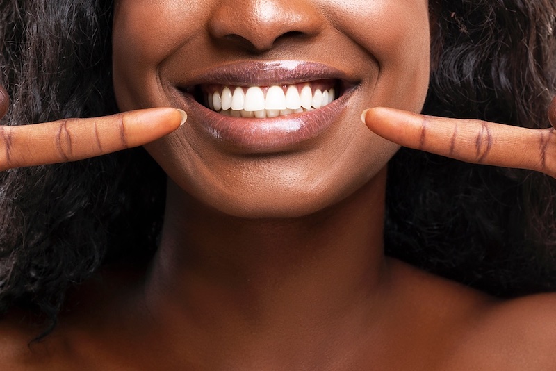 Here’s Why Pro Teeth Whitening Is The Answer in Burke, VA