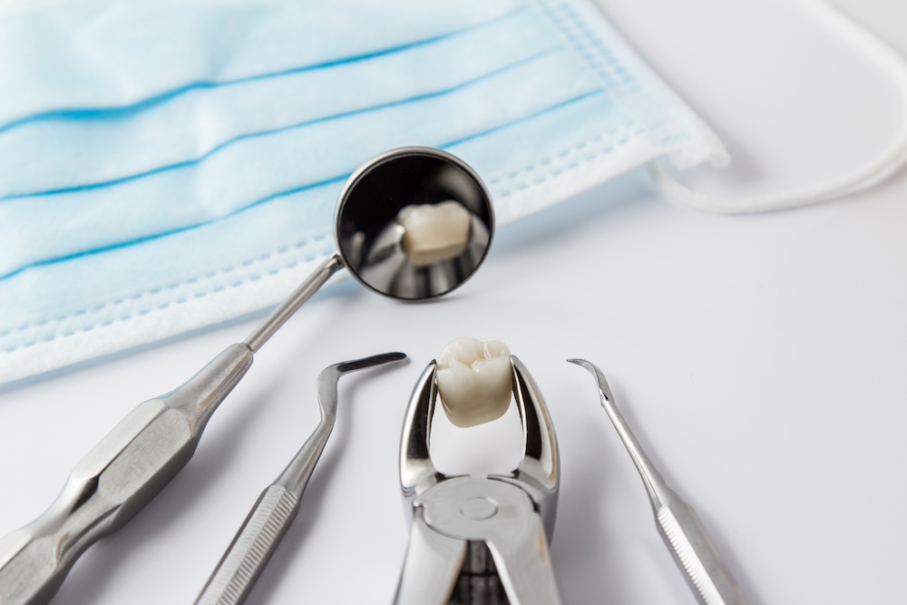 Tooth Extraction and Aftercare guide by Burke Dental